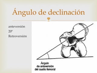 Ángulo de declinación 
 
anteversión 
20º 
Retroversión 
 