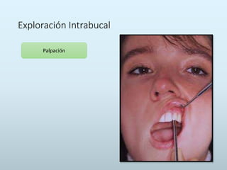 Exploración Intrabucal
Palpación
 