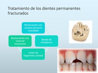 Tratamiento de los dientes permanentes
fracturados
Restauración con
coronas de acero
inoxidable
Banda de
ortodoncia
Unión de
fragmento coronal
Restauración con
material
compuesto
 