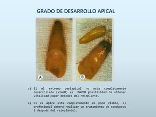 GRADO DE DESARROLLO APICAL
a) Si el extremo periapical no esta completamente
desarrollado (+1mmD) es MAYOR posibilidad de obtener
vitalidad pupar después del reimplante.
a) Si el ápice esta completamente es poco viable, el
profesional deberá realizar un tratamiento de conductos
( después del reimplante).
 
