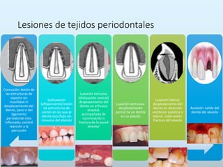 Lesiones de tejidos periodontales
Concusión: lesión de
las estructuras de
soporte sin
movilidad ni
desplazamiento del
diente, pero si del
ligamento
periodontal esta
inflamado, existirá
reacción a la
percusión
Subluxación
(aflojamiento) lesión
de estructuras de
sostén en las que el
diente esta flojo sin
moverse del alveolo
Luxación intrusiva
(dislocación central)
desplazamiento del
diente en el hueso
alveolar,
acompañada de
conminación o
fractura de la pared
alveolar
Luxación extrusiva:
desplazamiento
parcial de un diente
en su alveolo
Luxación lateral:
desplazamiento del
diente en dirección
vestibular palatina o
lateral. suele existir
fractura del alveolo
Avulsión: salida del
diente del alveolo
 