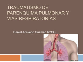 TRAUMATISMO DE
PARENQUIMA PULMONAR Y
VIAS RESPIRATORIAS
Daniel Acevedo Guzmán R2CG
 
