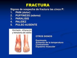 Signos de sospecha de fractura las cinco P:
1. PAIN (dolor)
2. PUFFINESS (edema)
3. PARALISIS
4. PALIDEZ
5. PULSO AUSENTE
OTROS SIGNOS
Equimosis
Aumento de la temperatura
Contusiones
Espasmo muscular
FRACTURA
 