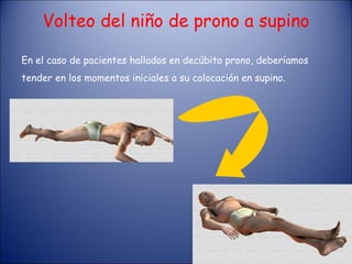Volteo del niño de prono a supino En el caso de pacientes hallados en decúbito prono, deberíamos tender en los momentos iniciales a su colocación en supino. 