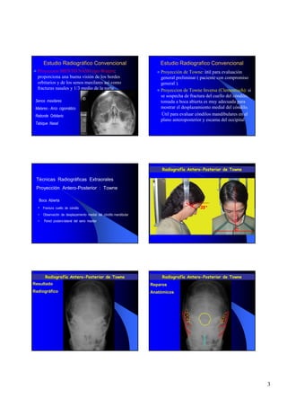 Estudio Radiográfico Convencional                                 Estudio Radiografico Convencional
  Proyeccion MENTO NASO tipo Waters:                                    Proyección de Towne: útil para evaluación
  proporciona una buena visión de los bordes                            general preliminar ( paciente con compromiso
  orbitarios y de los senos maxilares así como                          general ).
  fracturas nasales y 1/3 medio de la nariz                             Proyeccion de Towne Inversa (Clementisch): si
                                                                        se sospecha de fractura del cuello del cóndilo,
 Senos maxilares                                                        tomada a boca abierta es muy adecuada para
 Malares - Arco cigomático                                              mostrar el desplazamiento medial del cóndilo.
 Reborde Orbitario                                                       Útil para evaluar cóndilos mandibulares en el
                                                                        plano anteroposterior y escama del occipital
 Tabique Nasal




                                                                         Radiografía Antero-Posterior de Towne

 Técnicas Radiográficas Extraorales
 Proyección Antero-Posterior : Towne

   Boca Abierta
  • Fractura cuello de cóndilo
  •   Observación de desplazamiento medial del cóndilo mandibular
  •   Pared postero-lateral del seno maxilar

                                                                                                               .




       Radiografía Antero-Posterior de Towne                             Radiografía Antero-Posterior de Towne
Resultado                                                           Reparos
Radiográfico                                                        Anatómicos




                                                                                                                          3
 