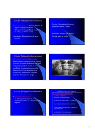 Estudio Radiografico Convencional
                                                   Técnicas Radiográficas Extraorales
  Proyección Lateral ( a distancia, laterales de
                                                   Proyección Lateral : Parma
  ángulo, cuerpo y rama; Parma ).
   Demuestra la integridad de la mandíbula,
  los senos y los huesos nasales.
                                                   Boca Abierta Distorsión por Amplitud
Diagnóstico diferencial con vía aérea              Fractura cuello de cóndilo
 superior




 Estudio Radiografico Convencional
  Ortopantomografía o Panorámica .
Para el paciente traumatizado es de elección
cuando el paciente es ambulatorio y de gran
rendimiento cuando la fractura es de la
mandíbula, ya que prácticamente no hay
sobreproyección con otras estructuras,
excepto en la zona anterior . ( equipos
modernos dan muy buena imagen )




 Estudio Radiografico Convencional                          TRAUMATOLOGIA MAXILOFACIAL
                                                    FRACTURAS MANDIBULARES
                                                     (AMBULATORIO)
  Submentovertex ( Axial ):                           RADIOGRAFÍA PANORÁMICA
  Se utiliza para visualizar los arcos
  cigomáticos ( menor kv ).Distorsión por             RX OCLUSAL PANORAMICA Y ESTRICTA
  amplitud.
                                                      RX EXTRAORAL POSTERO ANTERIOR

                                                      PROYECCION TOWNE DE LOS CONDILOS
                                                      MANDIBULARES

                                                      RX SUBMENTOVERTEX ( AXIAL )




                                                                                          5
 