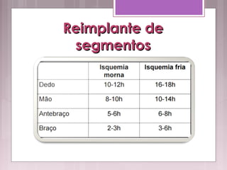 Reimplante deReimplante de
segmentossegmentos
 