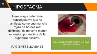 HIPOSFAGMA
Hemorragia o derrame
subconjuntival que se
manifiesta como una mancha
rojiza de bordes mal
definidos, de mayor o menor
extensión por encima de la
superficie escleral.
PACIENTES JÓVENES
17
SOLUCIÓN ESPONTÁNEA DE 5 – 10 DÍAS
HASTA 10 – 38 DÍAS
 