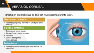 ABRASIÓN CORNEAL
18
Mecanismo de lesión
• Arañazo (rasguño), impacto de un objeto romo
en el ojo.
Signos y síntomas
• Dolor agudo c/mov ocular
• Sensación de cuerpo extraño
• Fotofobia
• Exceso de lagrimeo
• Visión borrosa
Tratamiento
• Ungüento antibacteriano, parche (cambiar 2-4
veces/día)
Brecha en el epitelio que se tiñe con Fluoresceína durante la EF.
 