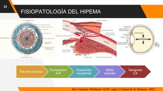 FISIOPATOLOGÍA DEL HIPEMA
22
Trauma contuso
Compresión
A-P
Expansión
ecuatorial
Daño
vascular
Sangrado
CA
Rev Cubana Oftalmol vol.25 supl.1 Ciudad de la Habana 2012
 
