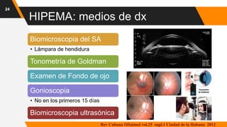 HIPEMA: medios de dx
Biomicroscopia del SA
• Lámpara de hendidura
Tonometría de Goldman
Examen de Fondo de ojo
Gonioscopia
• No en los primeros 15 días
Biomicroscopia ultrasónica
24
Rev Cubana Oftalmol vol.25 supl.1 Ciudad de la Habana 2012
 