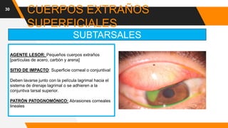 30
CUERPOS EXTRAÑOS
SUPERFICIALES
AGENTE LESOR: Pequeños cuerpos extraños
[partículas de acero, carbón y arena]
SITIO DE IMPACTO: Superficie corneal o conjuntival
Deben lavarse junto con la película lagrimal hacia el
sistema de drenaje lagrimal o se adhieren a la
conjuntiva tarsal superior.
PATRÓN PATOGNOMÓNICO: Abrasiones corneales
lineales
SUBTARSALES
 