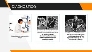 DIAGNÓSTICO
Diagnóstico en su mayoría
clínico.
TC: adecuada para
demostrar alteraciones
óseas como fractura del
conducto óptico.
RM: superior a la TC para
evaluar cambios de los
tejidos blandos (p. ej., un
hematoma) y oseos.
 