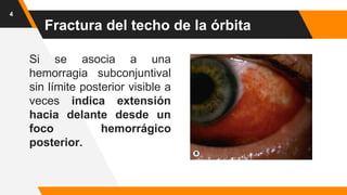 Si se asocia a una
hemorragia subconjuntival
sin límite posterior visible a
veces indica extensión
hacia delante desde un
foco hemorrágico
posterior.
4
Fractura del techo de la órbita
 