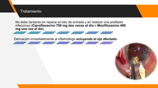 Tratamiento
No debe tardarse en reparar el sitio de entrada y en realizar una profilaxis
infecciosa (Ciprofloxacino 750 mg dos veces al día o Moxifloxacino 400
mg una vez al día).
Derivación inmediatamente al oftalmólogo ocluyendo el ojo afectado.
 