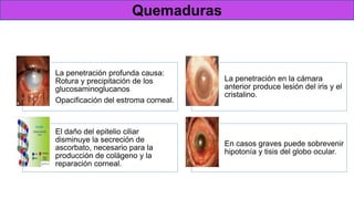 Fisiopatología
Progresión de lesiones
Quemaduras
La penetración profunda causa:
Rotura y precipitación de los
glucosaminoglucanos
Opacificación del estroma corneal.
La penetración en la cámara
anterior produce lesión del iris y el
cristalino.
El daño del epitelio ciliar
disminuye la secreción de
ascorbato, necesario para la
producción de colágeno y la
reparación corneal.
En casos graves puede sobrevenir
hipotonía y tisis del globo ocular.
 