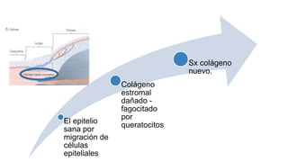Curación
El epitelio
sana por
migración de
células
epiteliales
Colágeno
estromal
dañado -
fagocitado
por
queratocitos
Sx colágeno
nuevo.
 