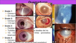 Clasificación de la gravedad
 Grado 1:
 Córnea transparente (solo lesión epitelial)
 Sin isquemia límbica (pronóstico excelente).
 Grado 2:
 Córnea turbia (detalles del iris visibles)
 <1/3 del limbo isquémico (buen pronóstico).
 Grado 3:
 Pérdida total del epitelio corneal
 Turbidez estromal que oculta los detalles del iris
 1/3 -1/2 de isquemia del limbo (pronóstico
reservado).
 Grado 4:
 Córnea opaca
Quemaduras
 
