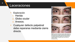 Laceraciones
▸ Exploración
1. Herida
2. Globo ocular
3. Anexos.
▸ Cualquier defecto palpebral
debe repararse mediante cierre
directo
6
 