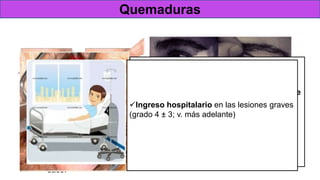 Tratamiento
 Irrigación copiosa:
 Durante 15-30 min (pH neutro)
 Instilarse anestesia tópica antes de la irrigación
 Puede ser útil colocar un blefaróstato.
Quemaduras
Doble eversión del párpado superior
Identificar y eliminar cualquier partícula retenida en los fondos de
saco.
Desbridamiento de las áreas necróticas de
epitelio corneal en la lámpara de hendiduraIngreso hospitalario en las lesiones graves
(grado 4 ± 3; v. más adelante)
 
