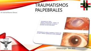 TRAUMATISMOS
PALPEBRALES
Dr. Erik Ariel Ramírez Almaraz
Oftalmología. Oct. 2022
 