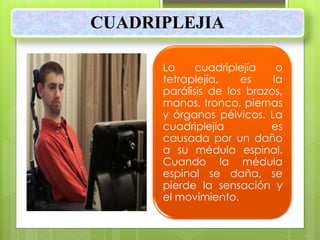 CUADRIPLEJIA
La cuadriplejía o
tetraplejía, es la
parálisis de los brazos,
manos, tronco, piernas
y órganos pélvicos. La
cuadriplejía es
causada por un daño
a su médula espinal.
Cuando la médula
espinal se daña, se
pierde la sensación y
el movimiento.
 