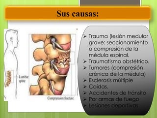 Sus causas:
 Trauma (lesión medular
grave: seccionamiento
o compresión de la
médula espinal.
 Traumatismo obstétrico.
 Tumores (compresión
crónica de la médula)
 Esclerosis múltiple
 Caídas.
 Accidentes de tránsito
 Por armas de fuego
 Lesiones deportivas
 
