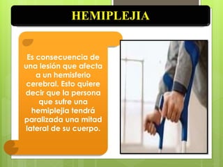 HEMIPLEJIA
Es consecuencia de
una lesión que afecta
a un hemisferio
cerebral. Esto quiere
decir que la persona
que sufre una
hemiplejia tendrá
paralizada una mitad
lateral de su cuerpo.
 