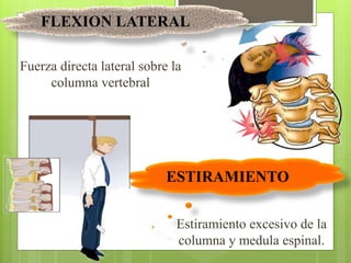 Fuerza directa lateral sobre la
columna vertebral
Estiramiento excesivo de la
columna y medula espinal.
FLEXION LATERAL
ESTIRAMIENTO
 