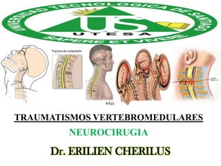 TRAUMATISMOS VERTEBROMEDULARES

NEUROCIRUGIA

Dr. ERILIEN CHERILUS

 