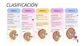 CLASIFICACIÓN
 