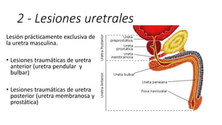 2 - Lesiones uretrales
Lesión prácticamente exclusiva de
la uretra masculina.
• Lesiones traumáticas de uretra
anterior (uretra pendular y
bulbar)
• Lesiones traumáticas de uretra
posterior (uretra membranosa y
prostática)
 