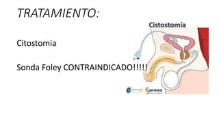 TRATAMIENTO:
Citostomia
Sonda Foley CONTRAINDICADO!!!!!
 