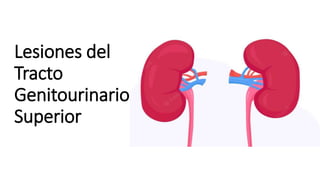 Lesiones del
Tracto
Genitourinario
Superior
 