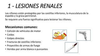 1 - LESIONES RENALES
Los riñones están protegidos por las costillas inferiores, la musculatura de la
espalda y la grasa perirrenal.
Se requiere una fuerza significativa para lesionar los riñones.
Mecanismos comunes:
• Colisión de vehículos de motor
• Caídas
• Golpes directos
• Fracturas de costillas inferiores
• Proyectiles de armas de fuego
• Heridas por arma blanca o punzantes
 