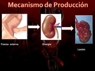 Fuerza externa   Energía

                           Lesión
 