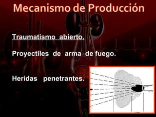 Traumatismo abierto.

Proyectiles de arma de fuego.


Heridas penetrantes.
 
