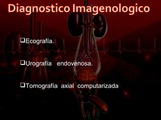 Ecografía.


Urografía endovenosa.


Tomografía axial computarizada
 