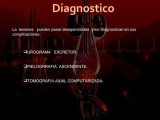 La lesiones pueden pasar desapercibidas y se diagnostican en sus
complicaciones.



     UROGRAMA EXCRETOR.


     PIELOGRRAFIA ASCENDENTE.


     TOMOGRAFIA AXIAL COMPUTARIZADA.
 