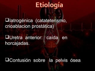Iatrogénica (catateterismo,
crioablacion prostática)

Uretra anterior: caída en
horcajadas.


Contusión sobre la pelvis ósea.
 
