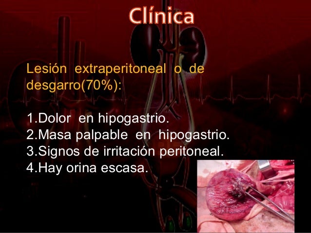 Traumatismo urogenital Traumatismo urogenital