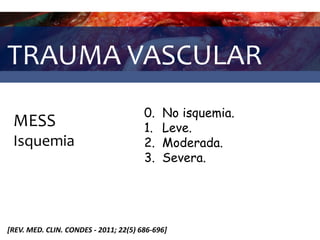 TRAUMA VASCULAR
MESS
Isquemia
0. No isquemia.
1. Leve.
2. Moderada.
3. Severa.
[REV. MED. CLIN. CONDES - 2011; 22(5) 686-696]
 