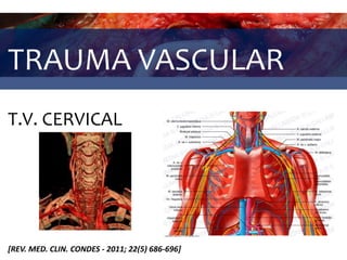 TRAUMA VASCULAR
T.V. CERVICAL
[REV. MED. CLIN. CONDES - 2011; 22(5) 686-696]
 