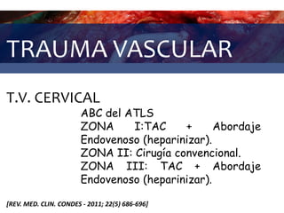 TRAUMA VASCULAR
T.V. CERVICAL
[REV. MED. CLIN. CONDES - 2011; 22(5) 686-696]
ABC del ATLS
ZONA I:TAC + Abordaje
Endovenoso (heparinizar).
ZONA II: Cirugía convencional.
ZONA III: TAC + Abordaje
Endovenoso (heparinizar).
 