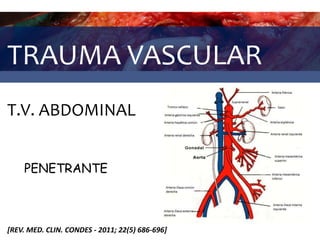 TRAUMA VASCULAR
T.V. ABDOMINAL
[REV. MED. CLIN. CONDES - 2011; 22(5) 686-696]
PENETRANTE
 