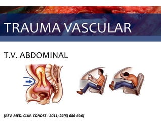 TRAUMA VASCULAR
T.V. ABDOMINAL
[REV. MED. CLIN. CONDES - 2011; 22(5) 686-696]
 