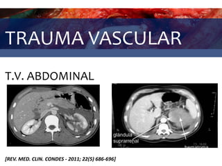 TRAUMA VASCULAR
T.V. ABDOMINAL
[REV. MED. CLIN. CONDES - 2011; 22(5) 686-696]
 