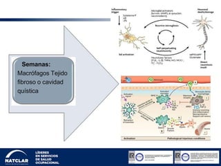 Semanas:
Macrófagos Tejido
fibroso o cavidad
quística
 