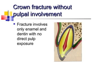 Crown fracture withoutCrown fracture without
pulpal involvementpulpal involvement
 Fracture involves
only enamel and
dentin with no
direct pulp
exposure
 