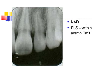 NAD
 PLS – within
normal limit
 